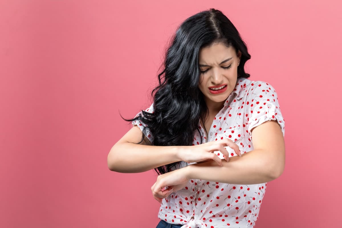 A young woman scratching her arm, similar to someone with scabies.