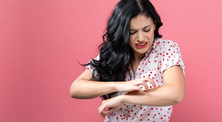 A young woman scratching her arm, similar to someone with scabies.