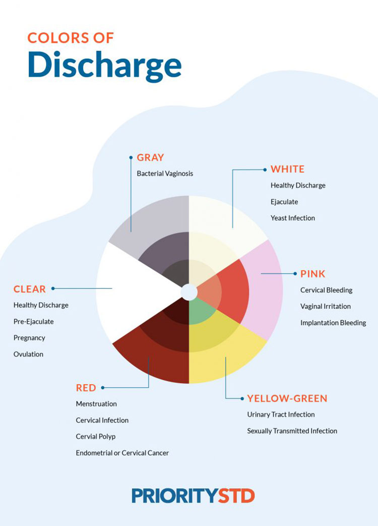 STD Discharge, STD Discharge Chart