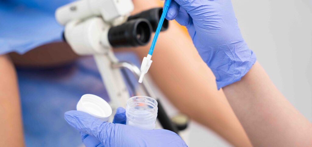 icd 10 cm code for std testing